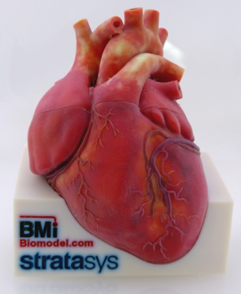 Illustrative 3D-printed model assembly of split heat with colored surface texture for anatomical education and technical demonstration.  Designed by Biomedical Modeling, Inc. (BMI). Manufactured by Stratasys Ltd.