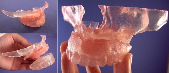 BioDental model of maxilla with soft tissue
