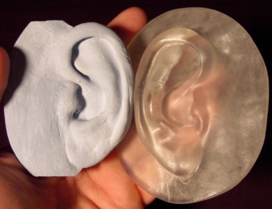 Biomodel of mirrored ear for custom prosthesis production.