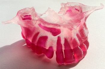 Image of maxilla model exhibiting impacted teeth.