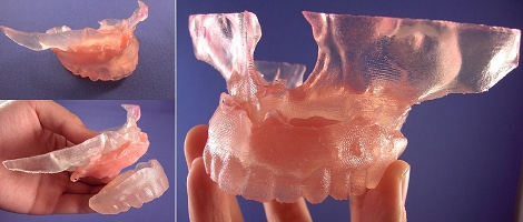 Image of maxilla and denture models with gingival soft tissue.
