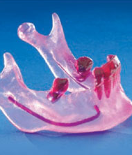 Mandibular biomodel featured in dental journal.